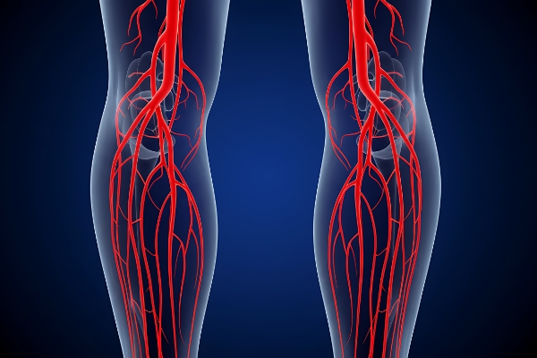 Illustration of the vascular anatomy of both lower legs